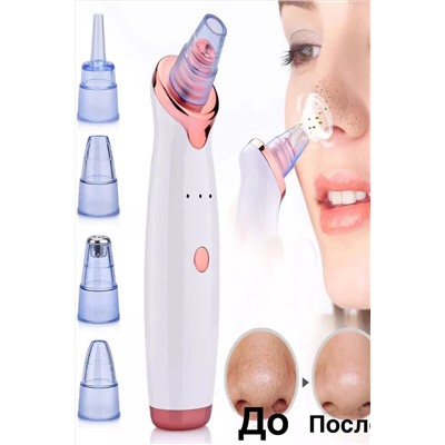 60710 Вакуумный очиститель пор НАТАЛИ, 1134793