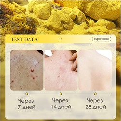 Серное мыло антибактериальное для проблемной кожи Sadoer Sulfur Soap, 125 гр.