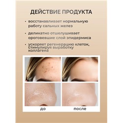 SADOER Отшелушивающий тонер с гликолевой кислотой Glycolic Acid 7% Toner, 230 мл