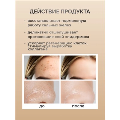 SADOER Отшелушивающий тонер с гликолевой кислотой Glycolic Acid 7% Toner, 230 мл
