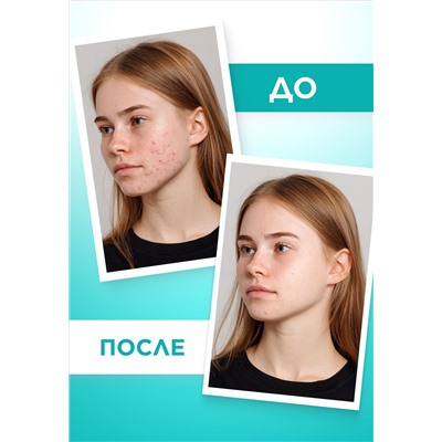 Гель для глубокого очищения кожи TeenSkin