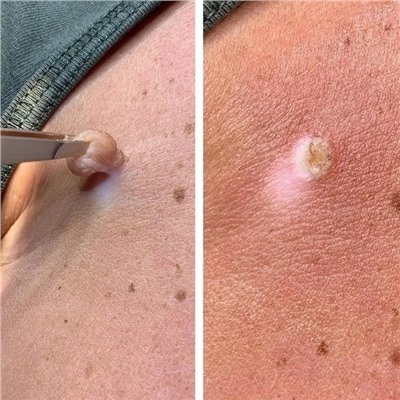 Сыворотка #22937776