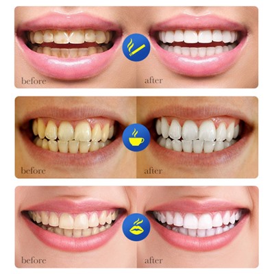 Зубная паста для удаления налета от сигарет Sadoer Smokes Stains, 100 гр.