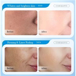 SADOER Увлажняющий крем для лица и шеи с гиалуроновой кислотой 8D , 30 гр