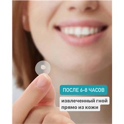 Гидроколлоидные пластыри от прыщей и акне, 40 шт