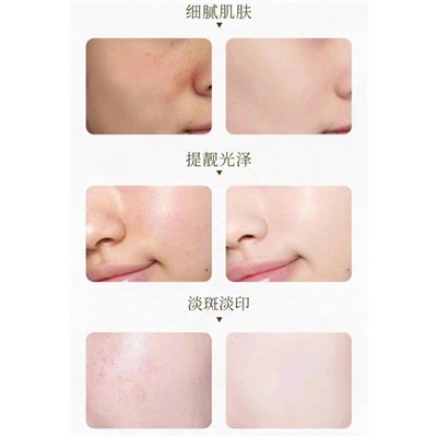 Сыворотка #23086079