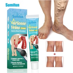 Мазь от варикоза Varicose Veins Sumifun