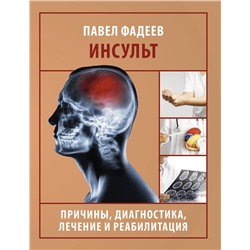 АСТ Павел Фадеев "Инсульт. Причины, диагностика, лечение и реабилитация"