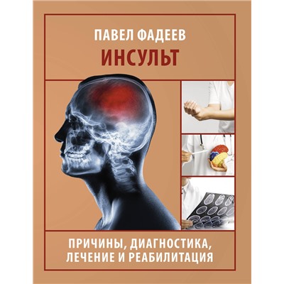 АСТ Павел Фадеев "Инсульт. Причины, диагностика, лечение и реабилитация"