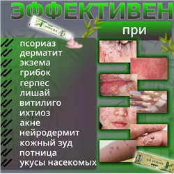 Зудафу Zudafu Семейный доктор Мазь Крем от псориаза, экземы и дерматита, 15 гр