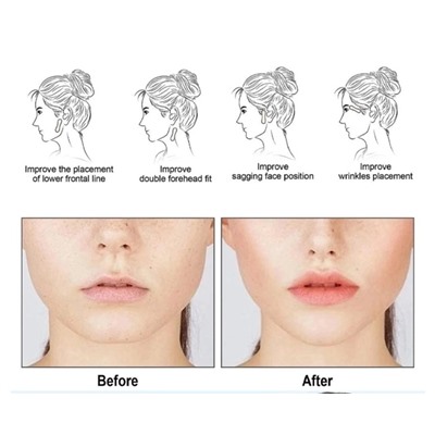 Артикул #23031460