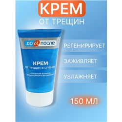 Крем для ног «До и После» от трещин в ступнях, 150 мл