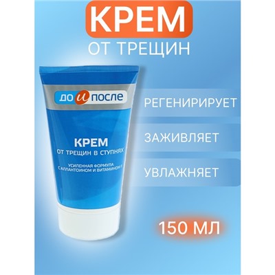 Крем для ног «До и После» от трещин в ступнях, 150 мл