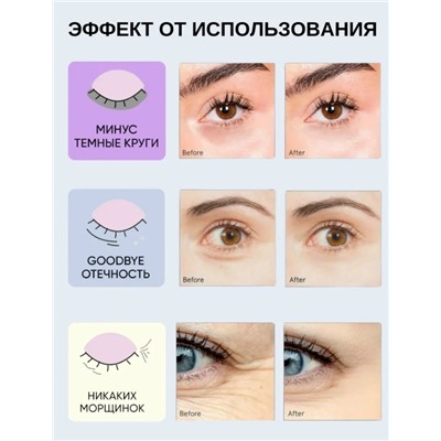 Патчи для вокруг глаз #23315759