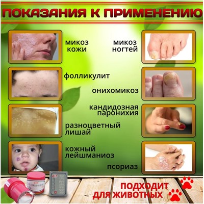 Мазь от псориаза и прыщей Король кожи - 7 гр.
