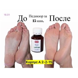 Ремувер 2051570-1