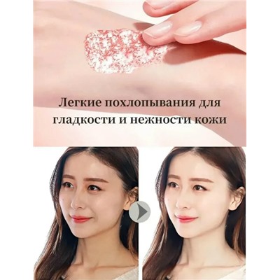 Крем для удаления веснушек #23080139