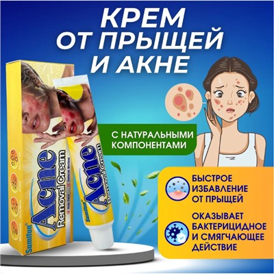 Крем от акне ,прыщей ,дерматита 30г