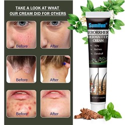 Антибактериальный крем от перхоти, дерматитов 20г