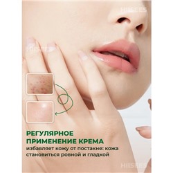 Крем от прыщей Hiisees, 20 г