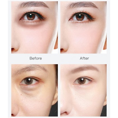 Маска под глаза с гиалуроновой кислотой и экстрактом центеллы азиатской VHA