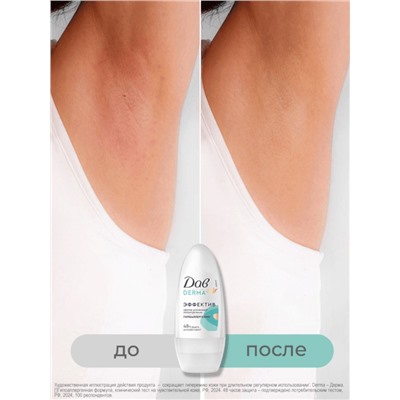 Дезодорант женский «Дав», гипоаллергенный, против сильного пота, 50 мл