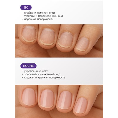 Лак-средство лечебная серия JEANMISHEL антигрибок, 6 мл