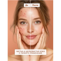 Гель для умывания SENDO от акне anti-acne cleansing gel, 200 мл