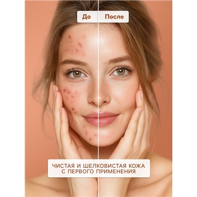 Гель для умывания SENDO от акне anti-acne cleansing gel, 200 мл