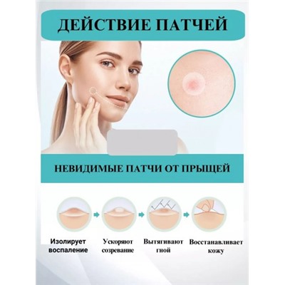 Гидроколлоидные пластыри от прыщей и акне, 40 шт