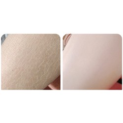 (НЕМНОГО ПОДТЕКШИЙ) Крем увлажняющий с мочевиной и витамином Е Bioaqua Vitamin E Urea Cream, 170 гр.