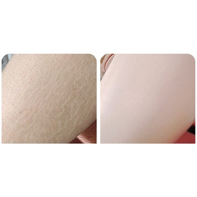 (НЕМНОГО ПОДТЕКШИЙ) Крем увлажняющий с мочевиной и витамином Е Bioaqua Vitamin E Urea Cream, 170 гр.