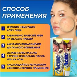Крем от акне ,прыщей ,дерматита 30г