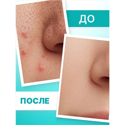Лосьон от черных точек TeenSkin