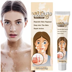 Крем от витилиго против пигментации и белых пятен ,антибактериальный 20гр