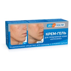 Крем-гель для проблемной кожи Анти-Акне До и После 50 мл.
