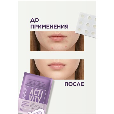 Патчи с микроиглами для проблемной кожи