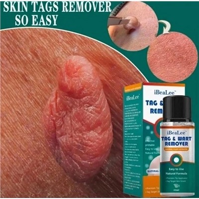 Сыворотка #22937776