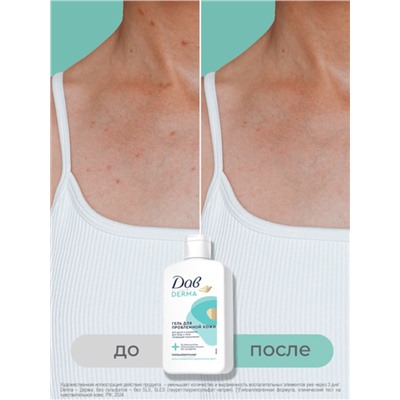 Гель для душа и умывания «Дав», для проблемной кожи, 280 мл