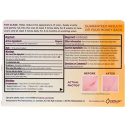 Mederma, Крем от шрамов, фактор защиты SPF 30, 20 г