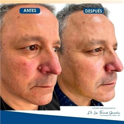 Сыворотка #22937776