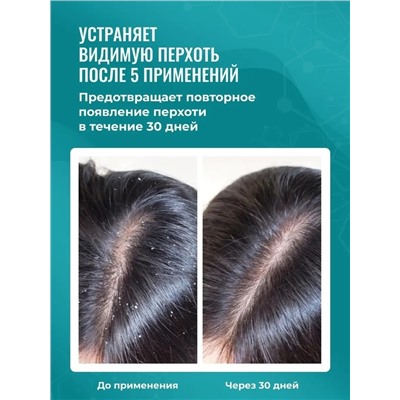 Шампунь #22965996