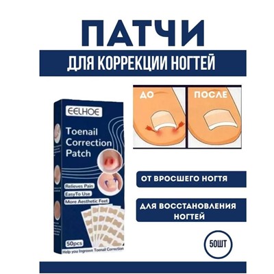 Пластыри наклеки для коррекции вросшего ногтя 50шт