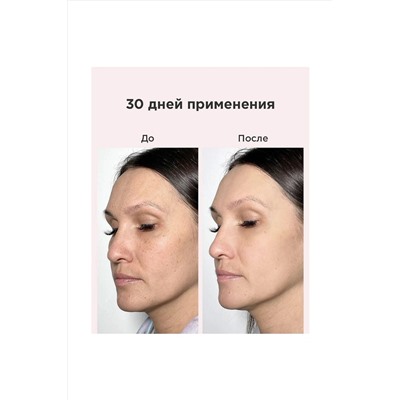 Likato Маска для лица комплекс / Anti-age Age Eraser, 50 мл KRISTALLER, 1107798
