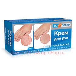 До и после Гидроактив крем для сухой кожи рук 100мл