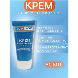 Крем «До и после» от пигментных пятен, 50 мл