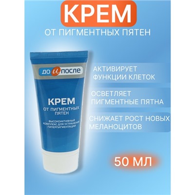 Крем «До и после» от пигментных пятен, 50 мл