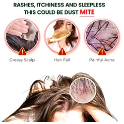 Для удаления подкожных  и вшей ,сыпи,зуда,для людей и домашних животных .20мл