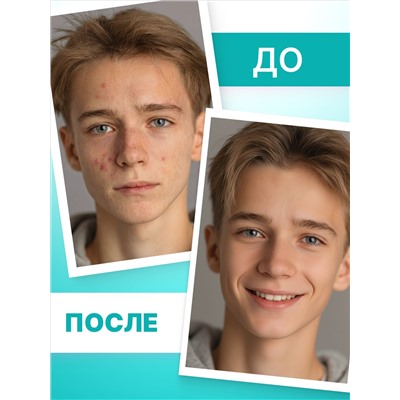 Сыворотка для лица с салициловой кислотой 2% и пантенолом TeenSkin
