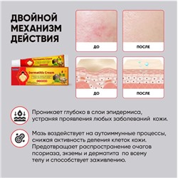 Мазь-крем от высыпаний на спине, псориаза, экземы, атопического дерматита,акне 20гр